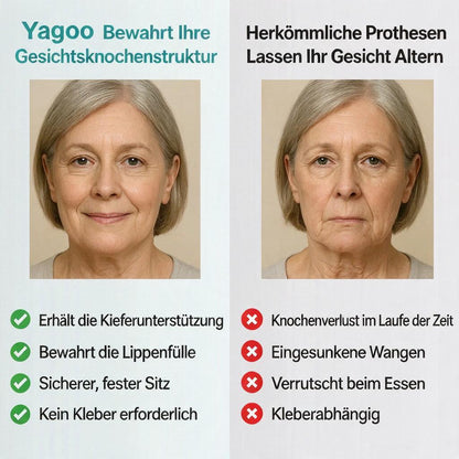 🎁Aktion endet heute: 70 % Rabatt! ⏰Yagoo™ Medizinische Vollprothese mit starkem Halt 🦷