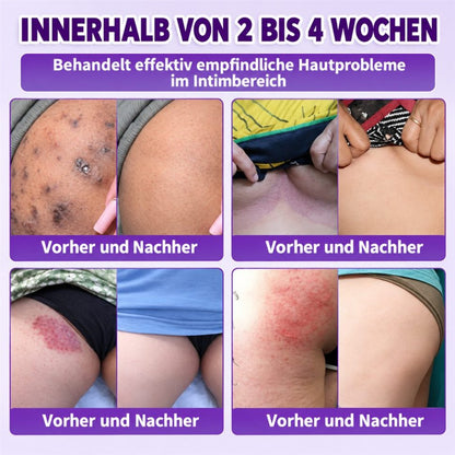 ✨ Hergestellt und versandt aus den USA ✨ QIAWI® Biotin 10-in-1 Hau