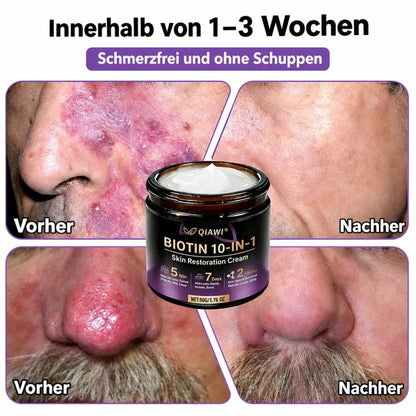 ✨ Hergestellt und versandt aus den USA ✨ QIAWI® Biotin 10-in-1 Hau