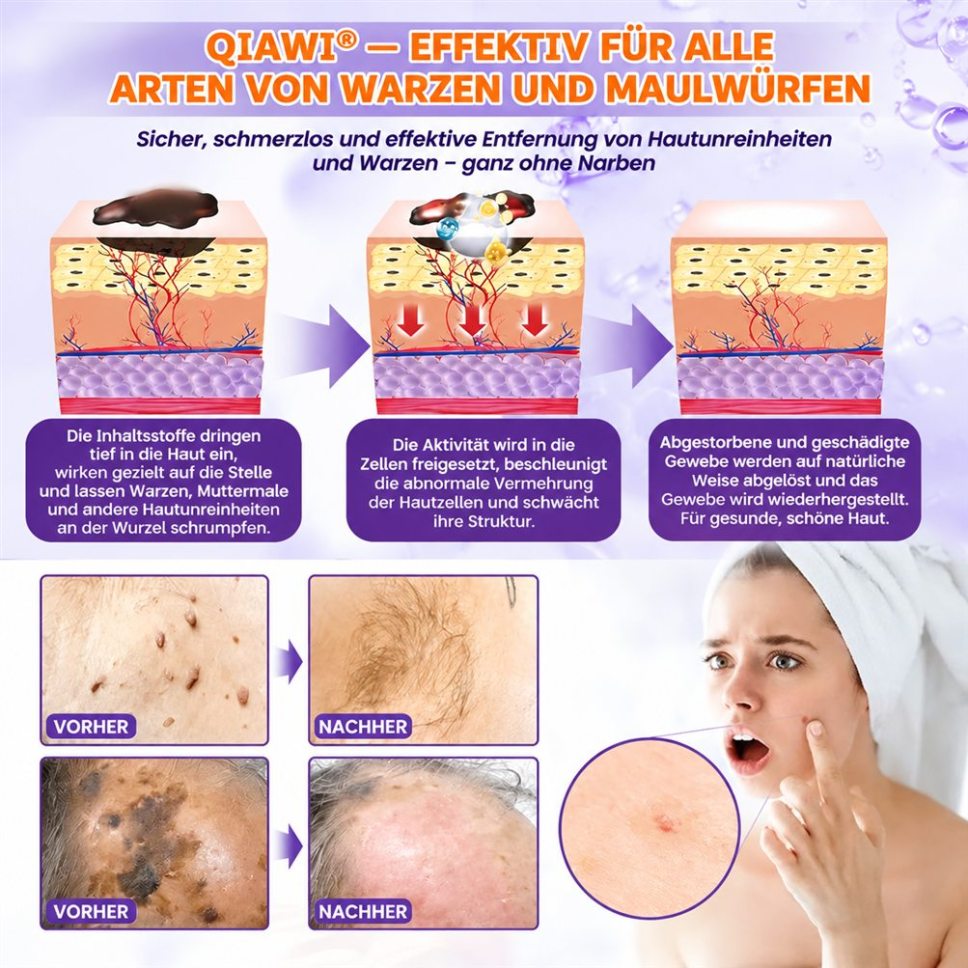 ✨ Hergestellt und versandt aus den USA ✨ QIAWI® Biotin 10-in-1 Hau