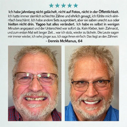 🎁Aktion endet heute: 70 % Rabatt! ⏰Yagoo™ Medizinische Vollprothese mit starkem Halt 🦷