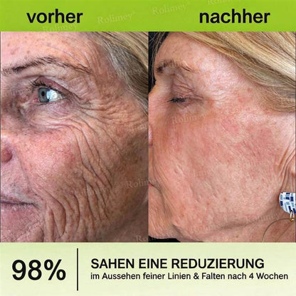 🔥Nur noch 3 Stunden: 70 % Rabatt🔥 QIAWI™ Botulinum & Vita-A Retinol Shot – Straffende Creme gegen Falten✨